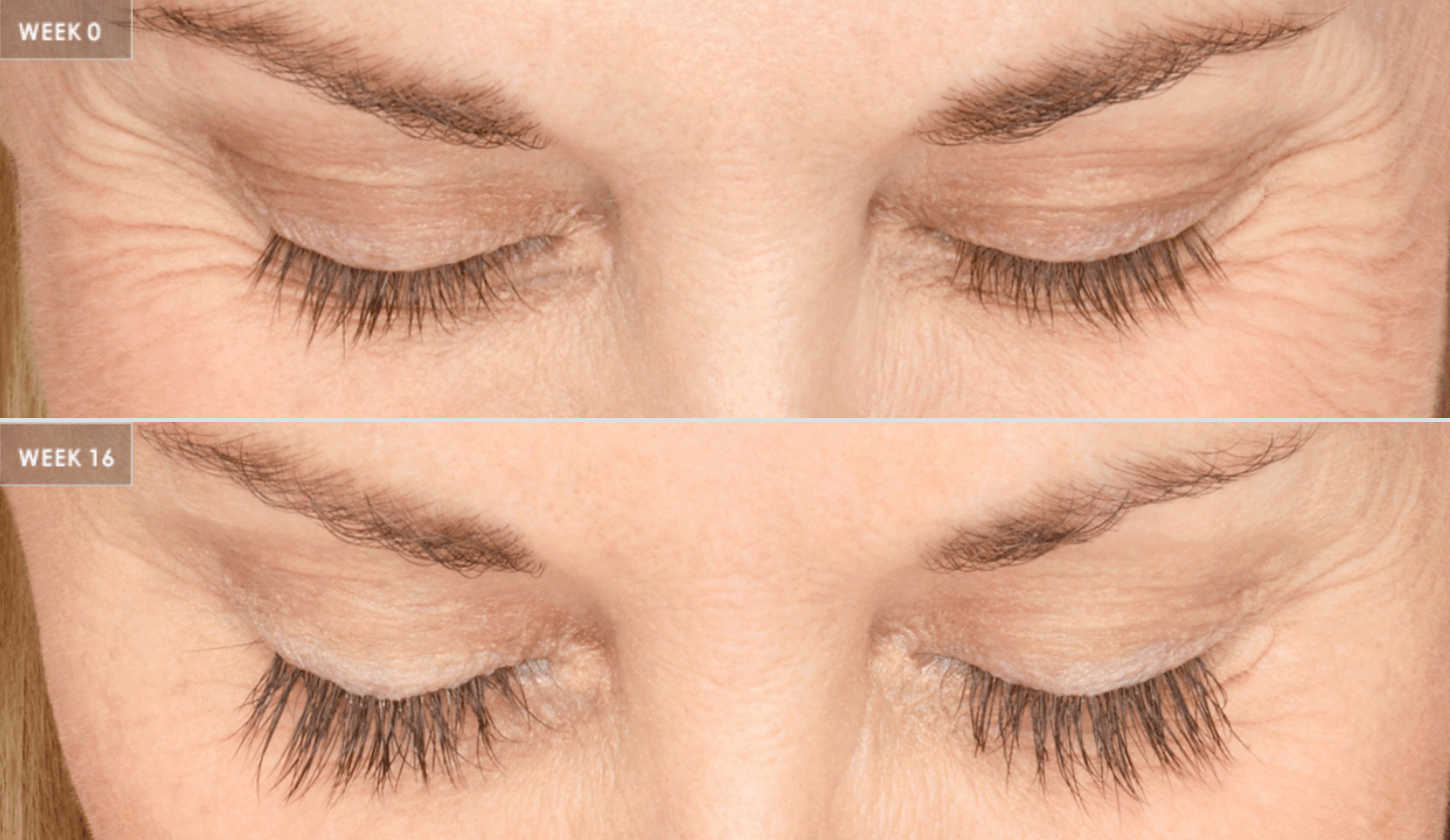 Latisse Eyelash Serum - Joseph Eye and Laser